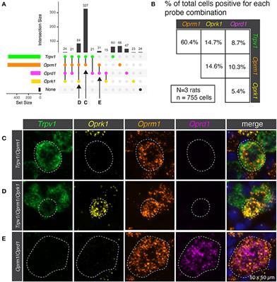 Anatomical Analysis of Transient Potential Vanilloid Receptor 1 (Trpv1+) and Mu-Opioid Receptor (Oprm1+) Co-expression in Rat Dorsal Root Ganglion Neurons